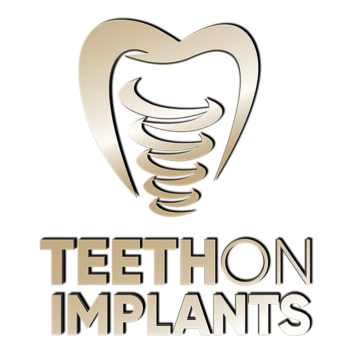 Tooth-on-implants-Med-Res-Colour